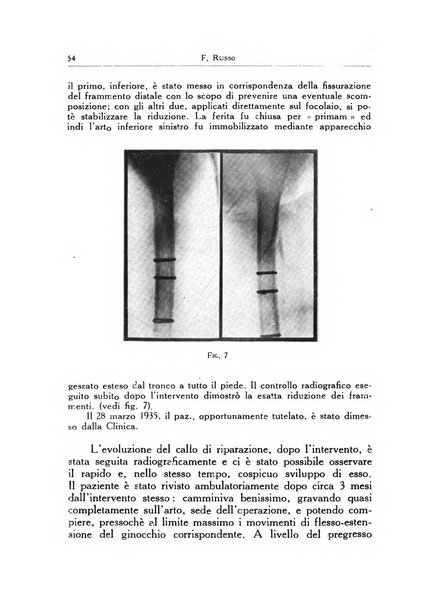 Ortopedia e traumatologia dell'apparato motore rivista bimestrale di cinematojatria