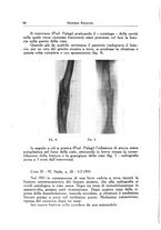 giornale/PUV0115492/1938/unico/00000102