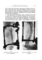 giornale/PUV0115492/1938/unico/00000341