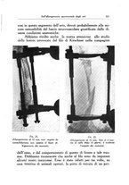 giornale/PUV0115492/1938/unico/00000349