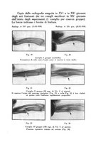 giornale/PUV0115492/1940/unico/00000125