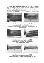 giornale/PUV0115492/1940/unico/00000129