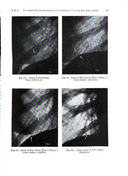 Radiologia e fisica medica. Sezione 1, Archivio di radioterapia e biofisica