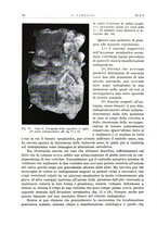 giornale/PUV0115511/1935/unico/00000062