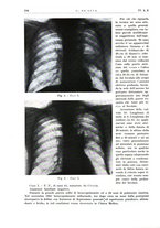 giornale/PUV0115511/1937/unico/00000174