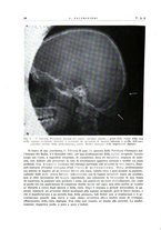 giornale/PUV0115511/1938/unico/00000082