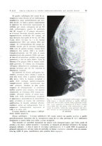 giornale/PUV0115511/1938/unico/00000085