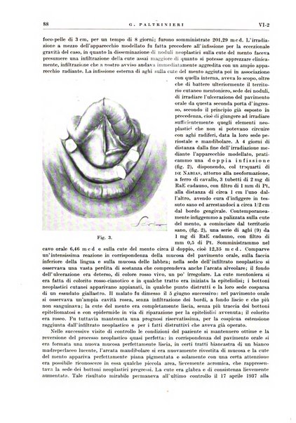 Radioterapia e fisica medica