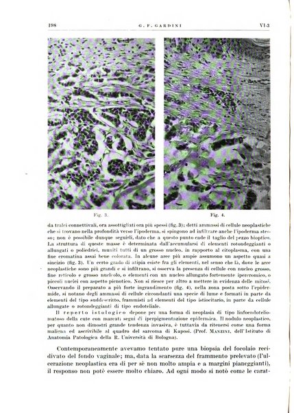 Radioterapia e fisica medica