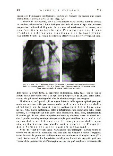 Radioterapia e fisica medica