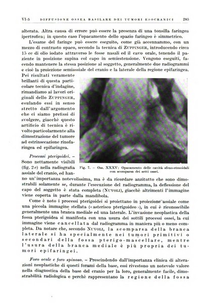 Radioterapia e fisica medica