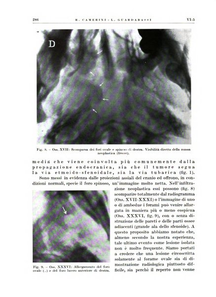 Radioterapia e fisica medica