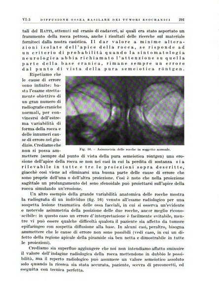 Radioterapia e fisica medica