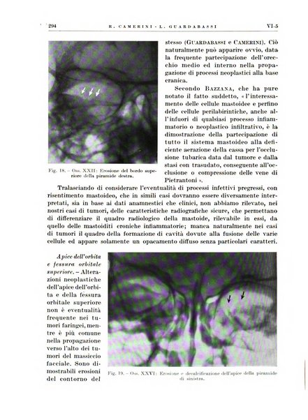 Radioterapia e fisica medica