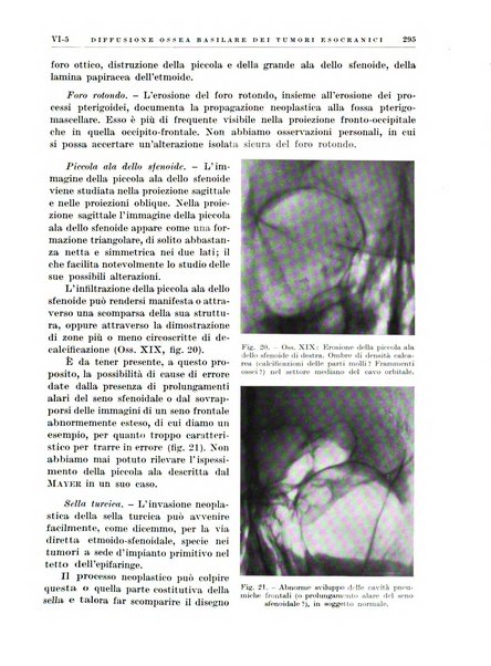 Radioterapia e fisica medica