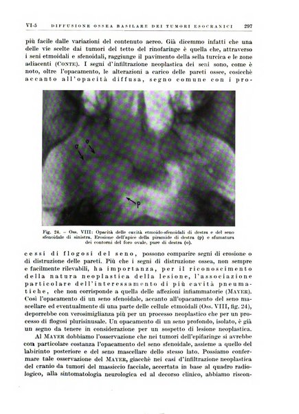 Radioterapia e fisica medica