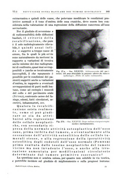 Radioterapia e fisica medica