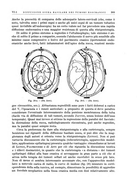 Radioterapia e fisica medica