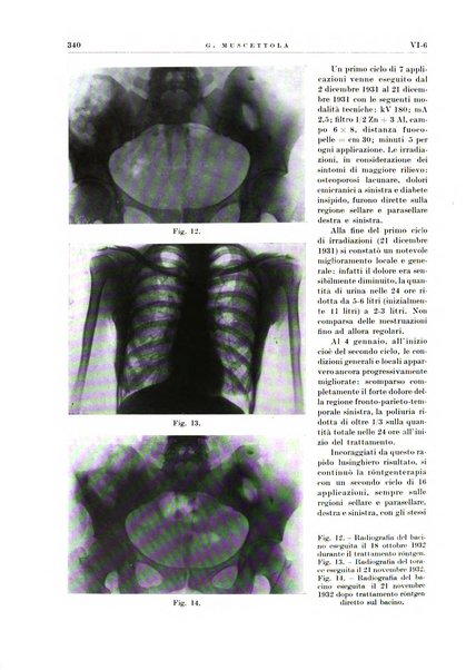 Radioterapia e fisica medica