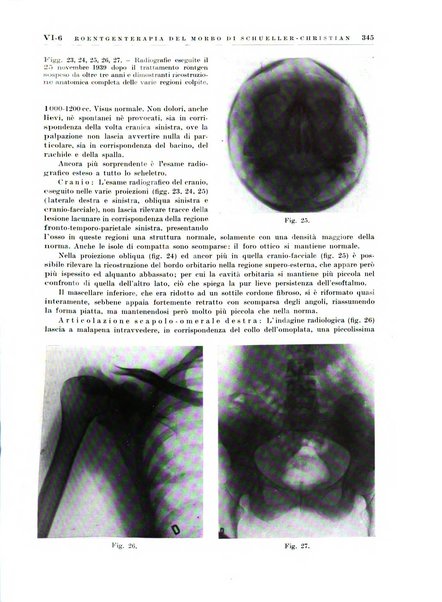 Radioterapia e fisica medica