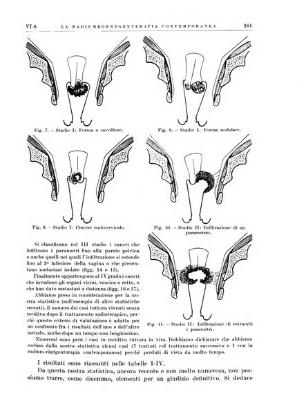 Radioterapia e fisica medica