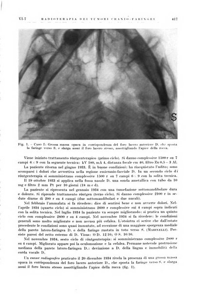 Radioterapia e fisica medica