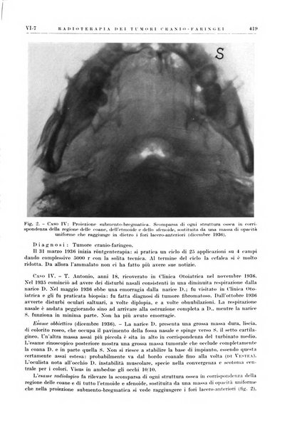 Radioterapia e fisica medica