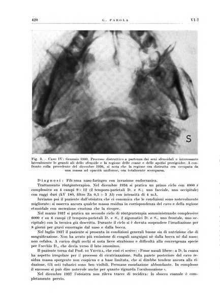 Radioterapia e fisica medica