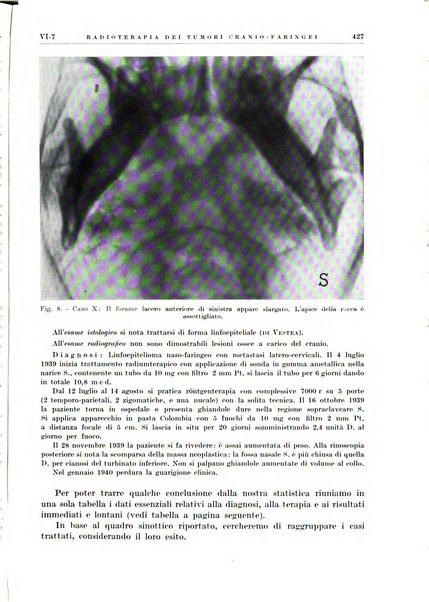 Radioterapia e fisica medica