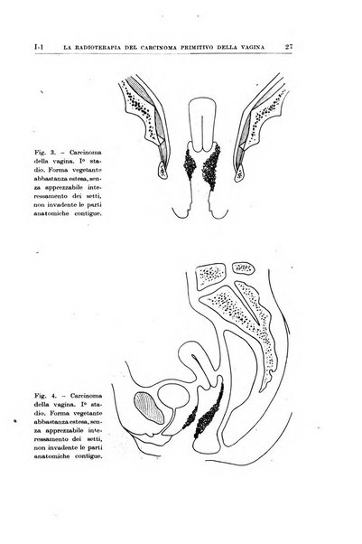 Radioterapia, radiobiologia e fisica medica