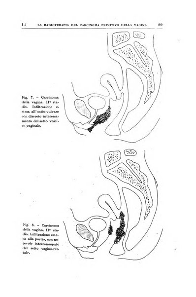 Radioterapia, radiobiologia e fisica medica