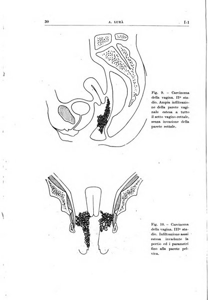 Radioterapia, radiobiologia e fisica medica