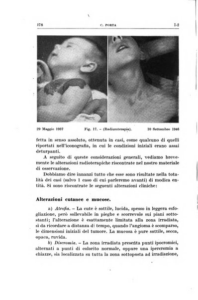 Radioterapia, radiobiologia e fisica medica