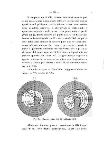 Archivio di oftalmojatria