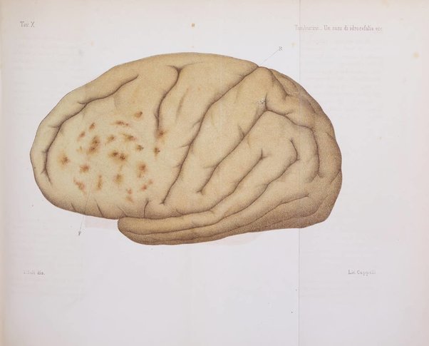 Rivista sperimentale di freniatria e di medicina legale in relazione con l'antropologia e le scienze giuridiche e sociali