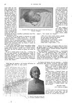 giornale/PUV0125392/1927/unico/00000386