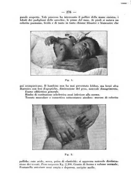 La pediatria pratica sezione pratica dell'archivio La clinica pediatrica