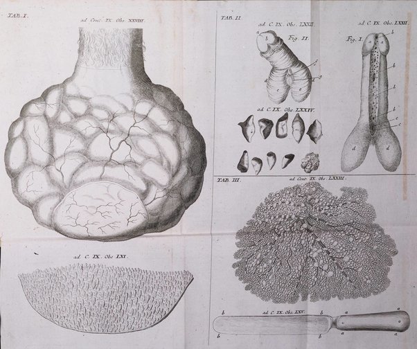 Academiae Caesareo-Leopoldinae naturae curiosorum ephemerides, sive Observationum medico.phisicarum ...