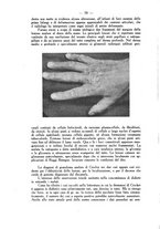 giornale/PUV0129597/1937/unico/00000084