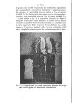 giornale/PUV0140996/1917/V.1/00000100