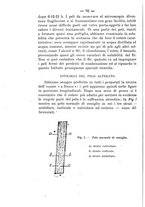 giornale/PUV0140996/1917/V.1/00000118