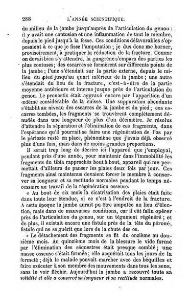 L'année scientifique et industrielle ou Exposé annuel des travaux scientifiques, des inventions et des principales applications de la science a l'industrie et aux arts, qui ont attiré l'attention publique en France et a l'etranger