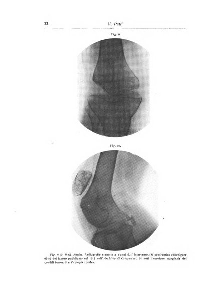 La chirurgia degli organi di movimento