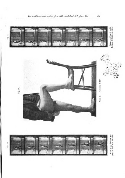 La chirurgia degli organi di movimento