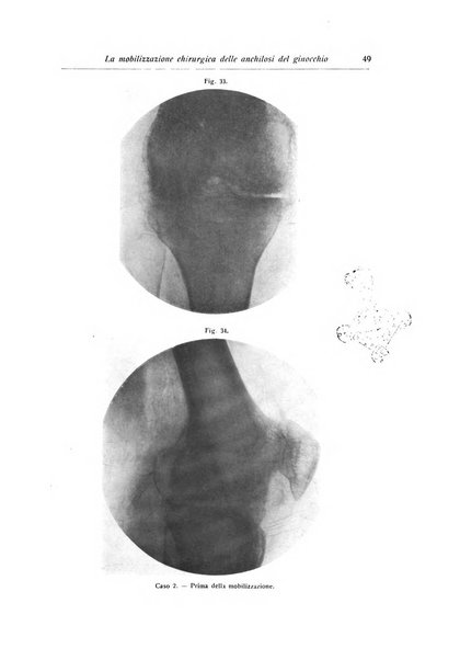 La chirurgia degli organi di movimento