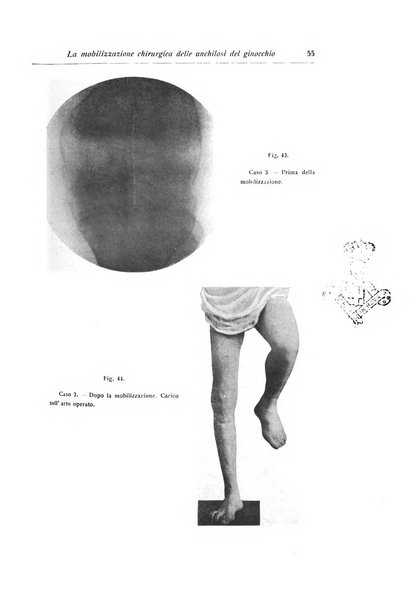 La chirurgia degli organi di movimento