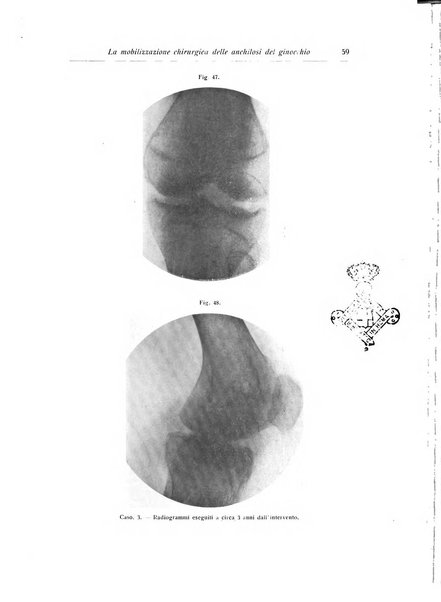 La chirurgia degli organi di movimento