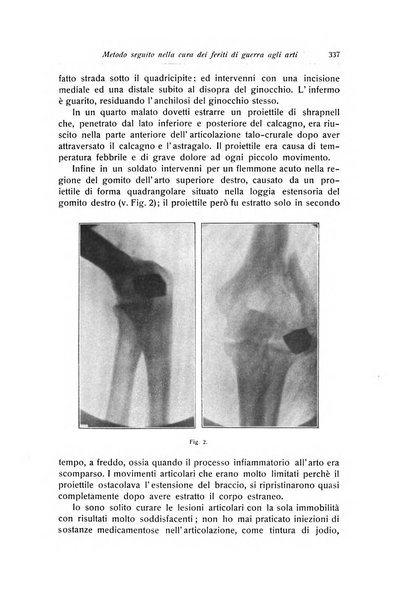 La chirurgia degli organi di movimento