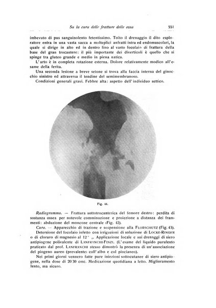 La chirurgia degli organi di movimento