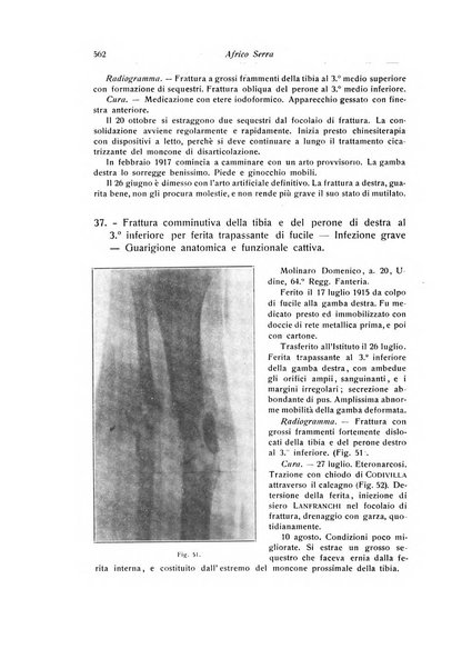 La chirurgia degli organi di movimento